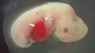 First human-pig embryos created